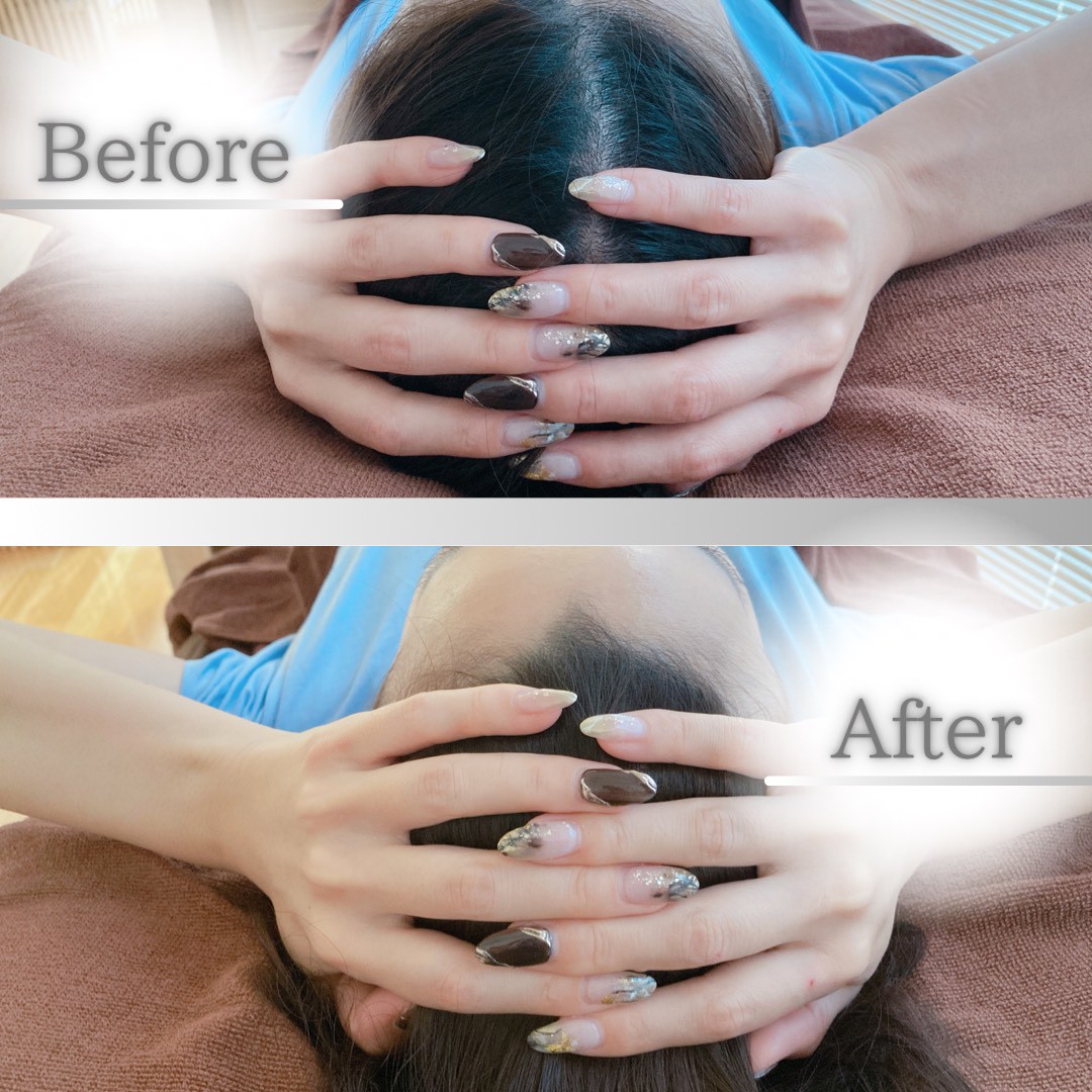 ビフォーアフター